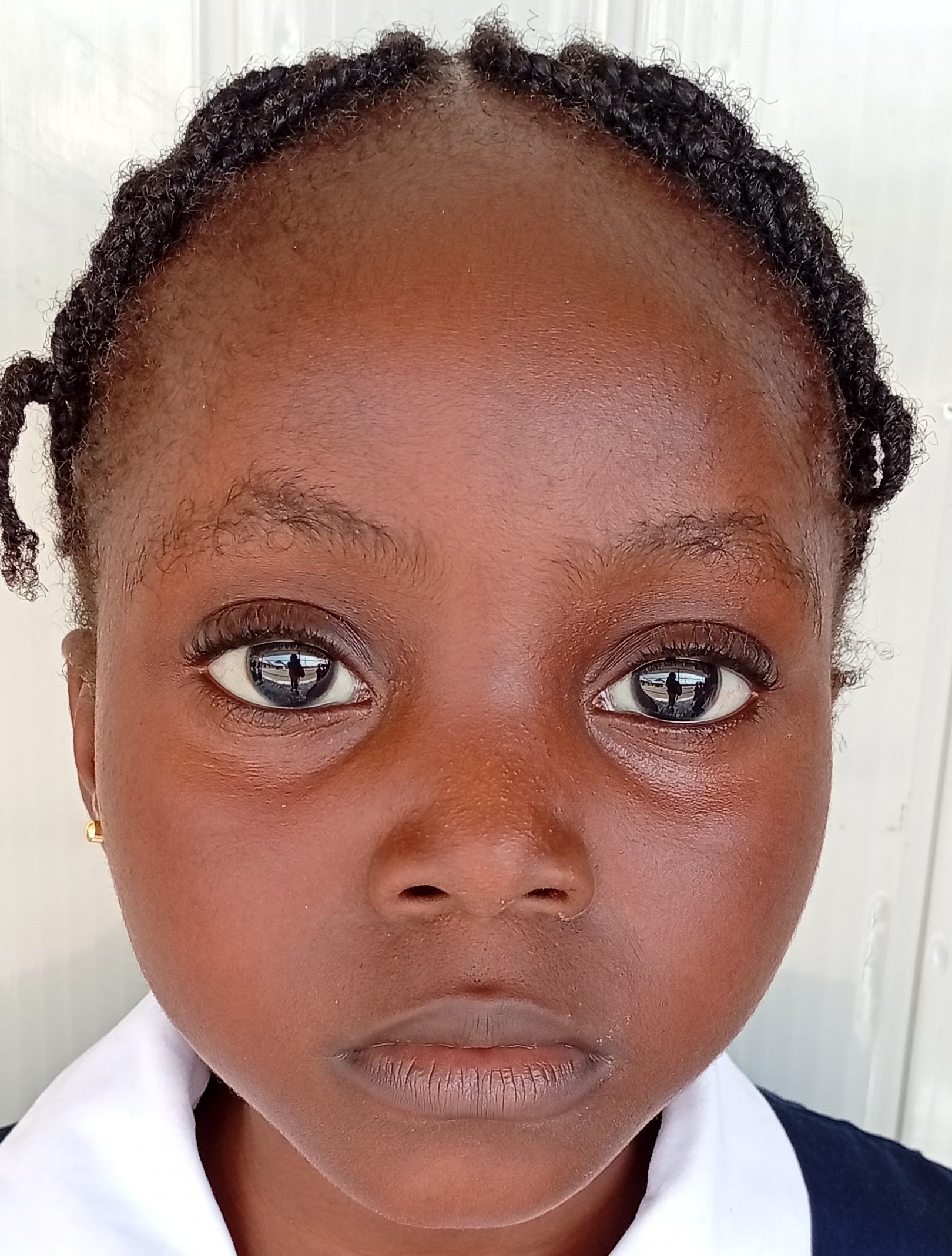 Protected: NURSERY 2